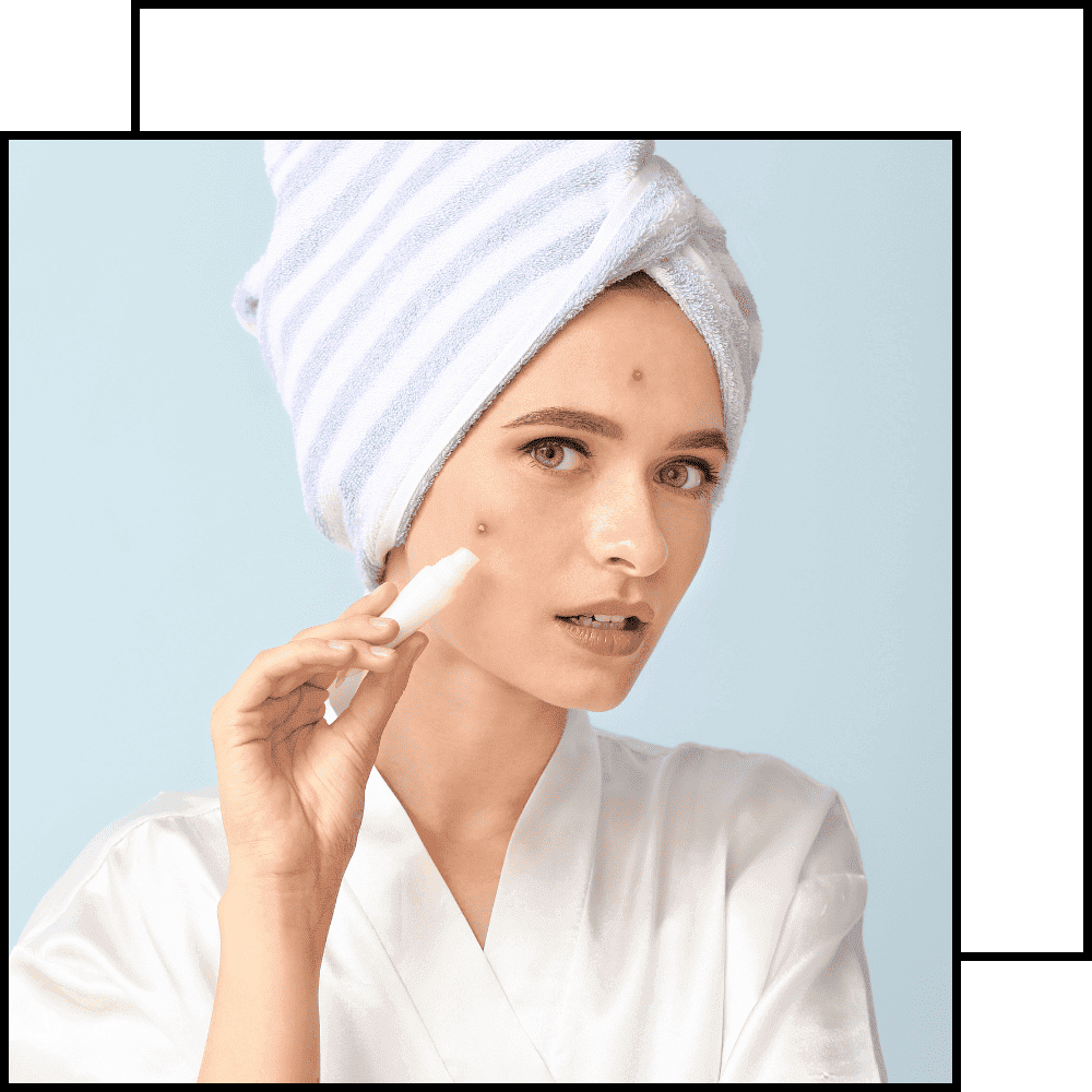 תמונה לטיפול אקנה